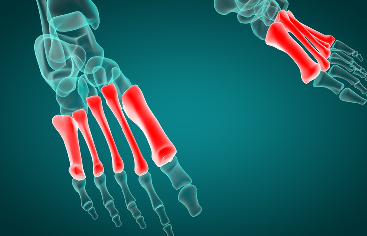 徹底解説 中足骨骨頭痛の原因は あなたの足の付け根の痛みの改善には が重要だった Sposhiru Com 徹底解説 中足骨骨頭痛の原因は あなたの足の付け根の痛みの改善には が重要だった Sposhiru Com
